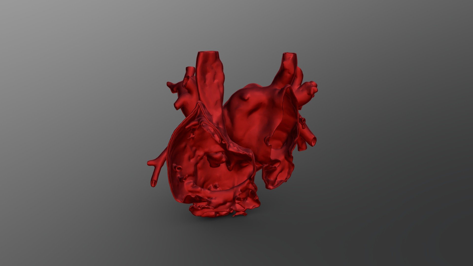 cardiac_anomalous