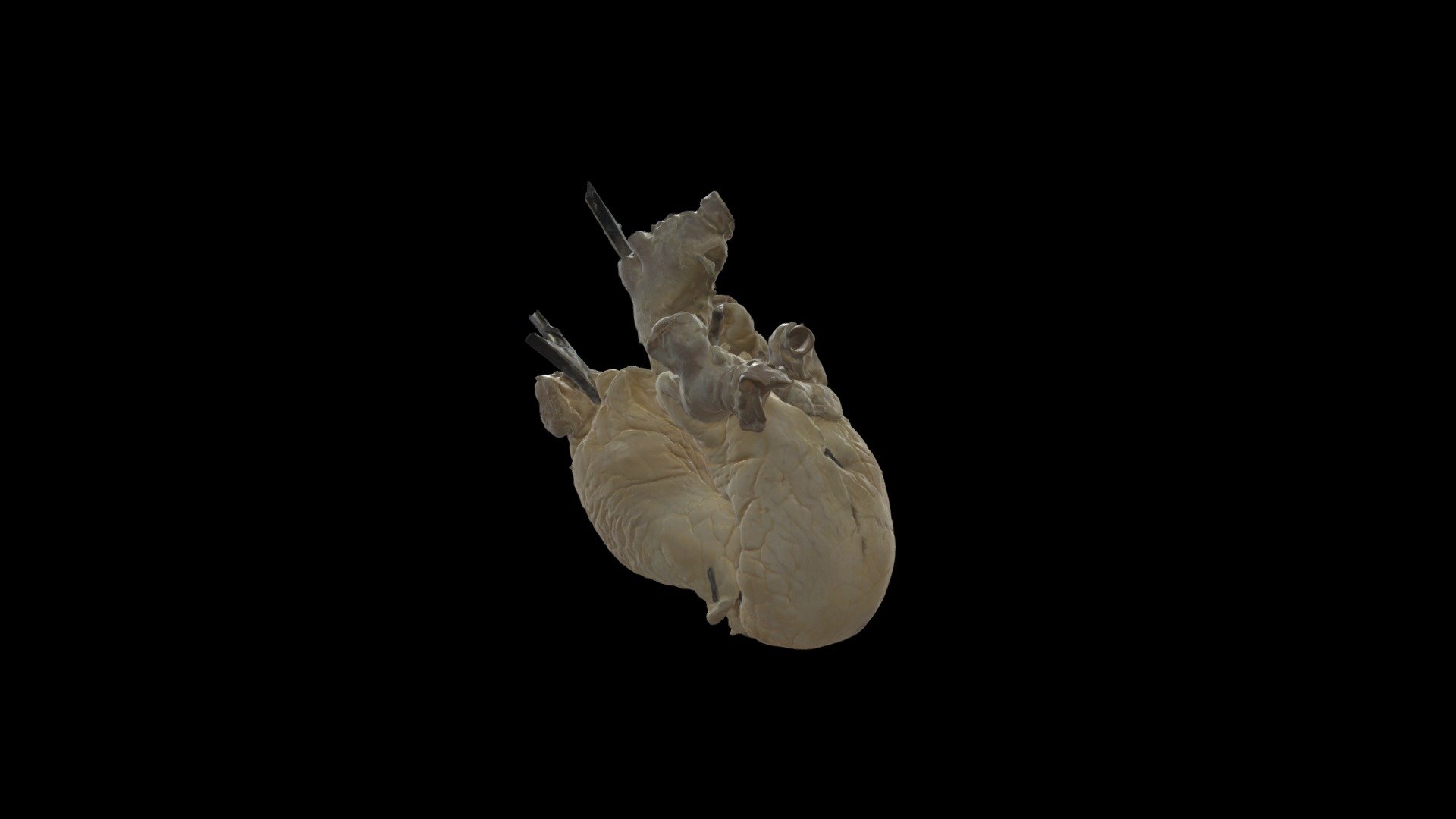 Human Heart #0013 External Anatomy - 3D model by VisibleHeartLabs ...