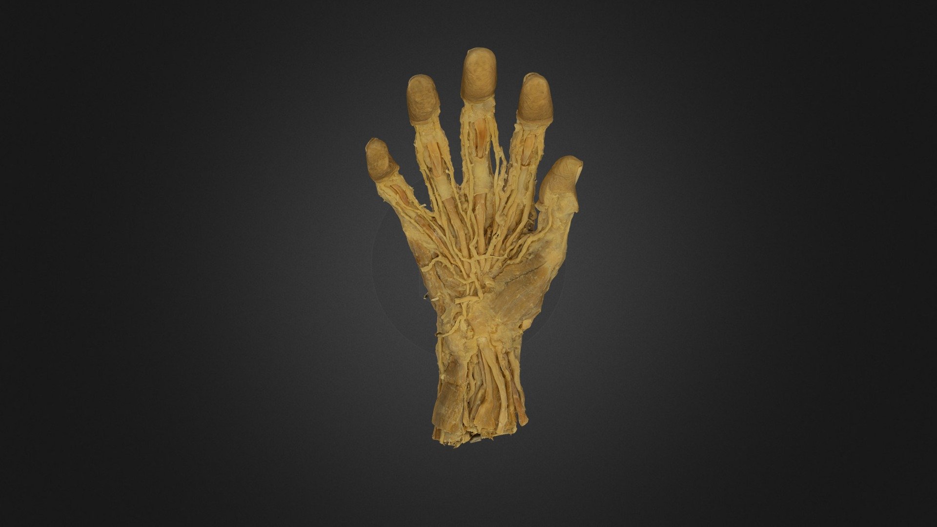 Plastinated Human Hand