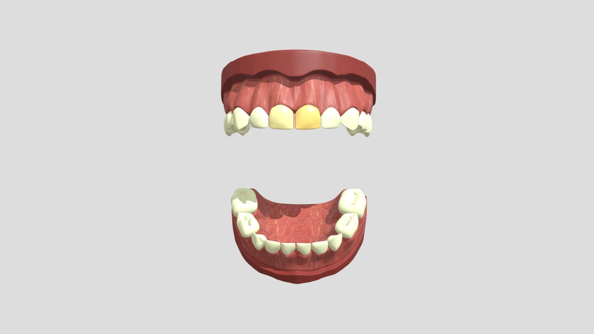 LC6_Model5
