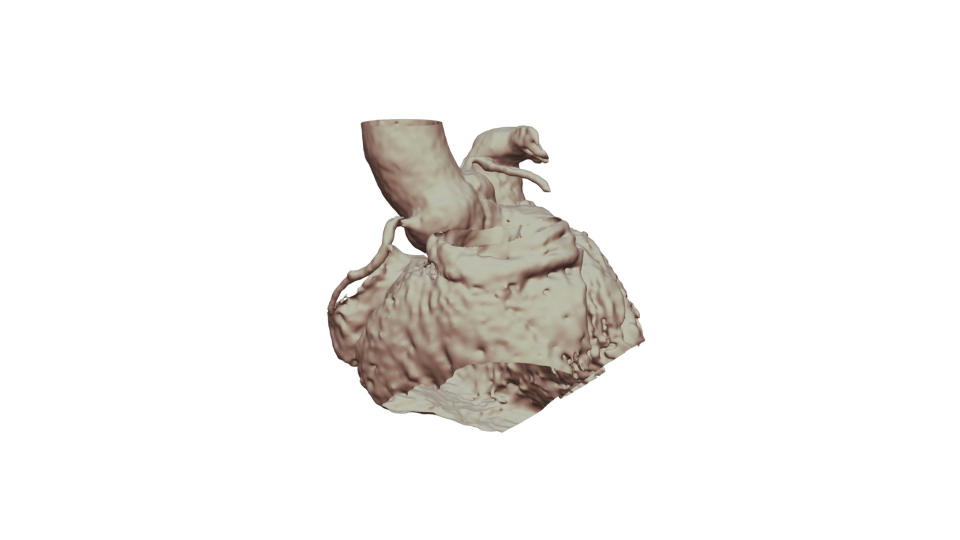 CIV 11112020 STL — Sketchfab embed 3D viewer