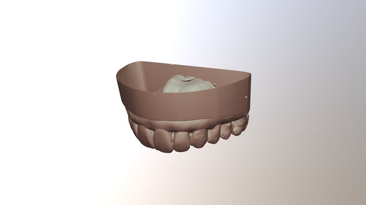 Dr Guo/ Wang Upper Jaw 3D Model
