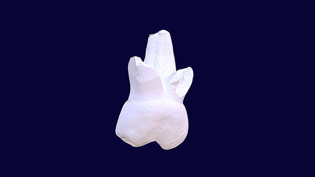 deciduos tooth 3D Model