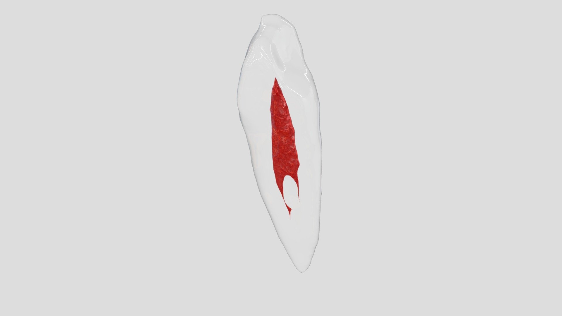 33 Endo