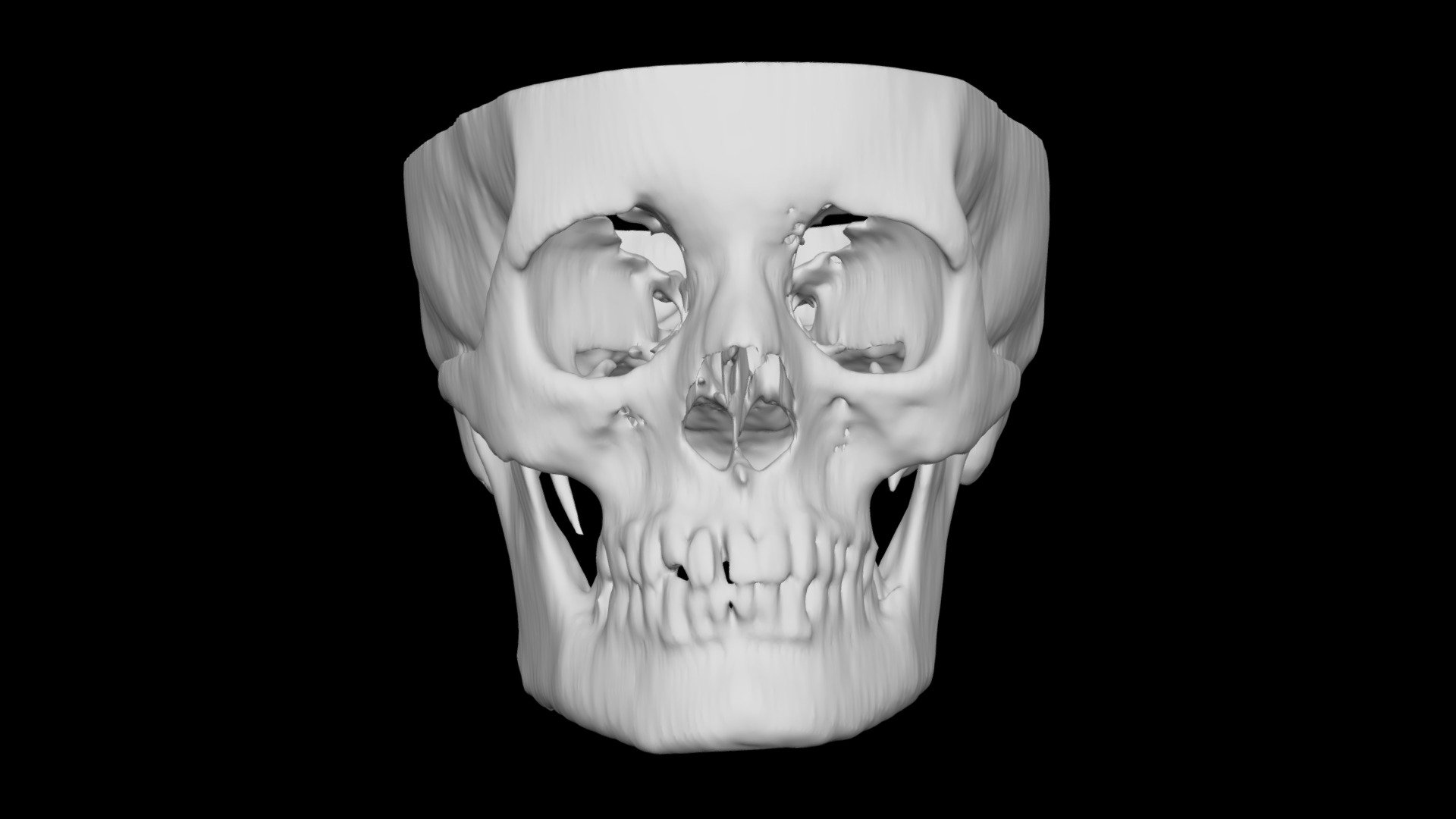Skull Female 51yo