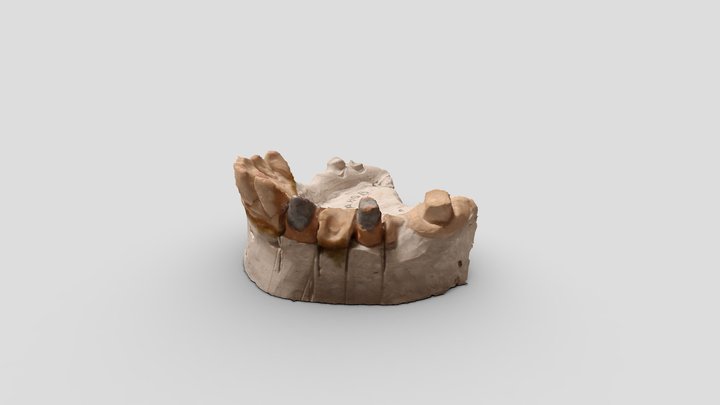 Dental model practice 3D Model