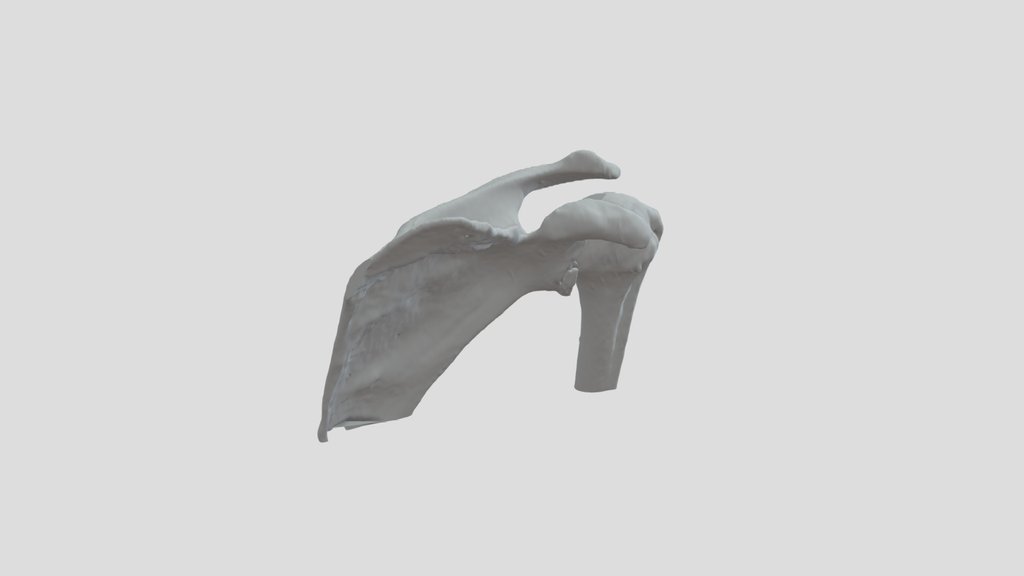 IDM Ebre Projecte 3D fractura escapular