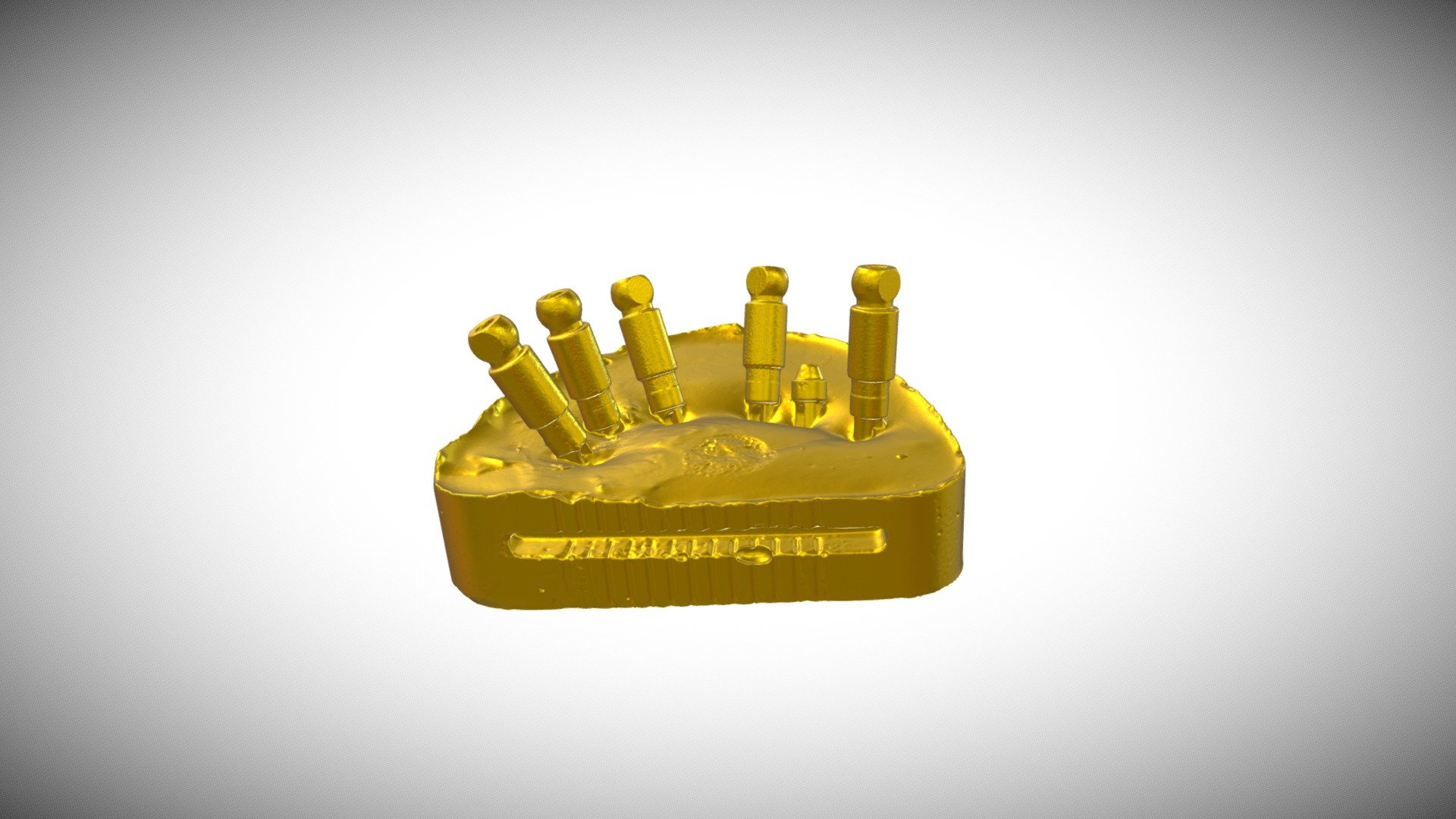 Implant denture