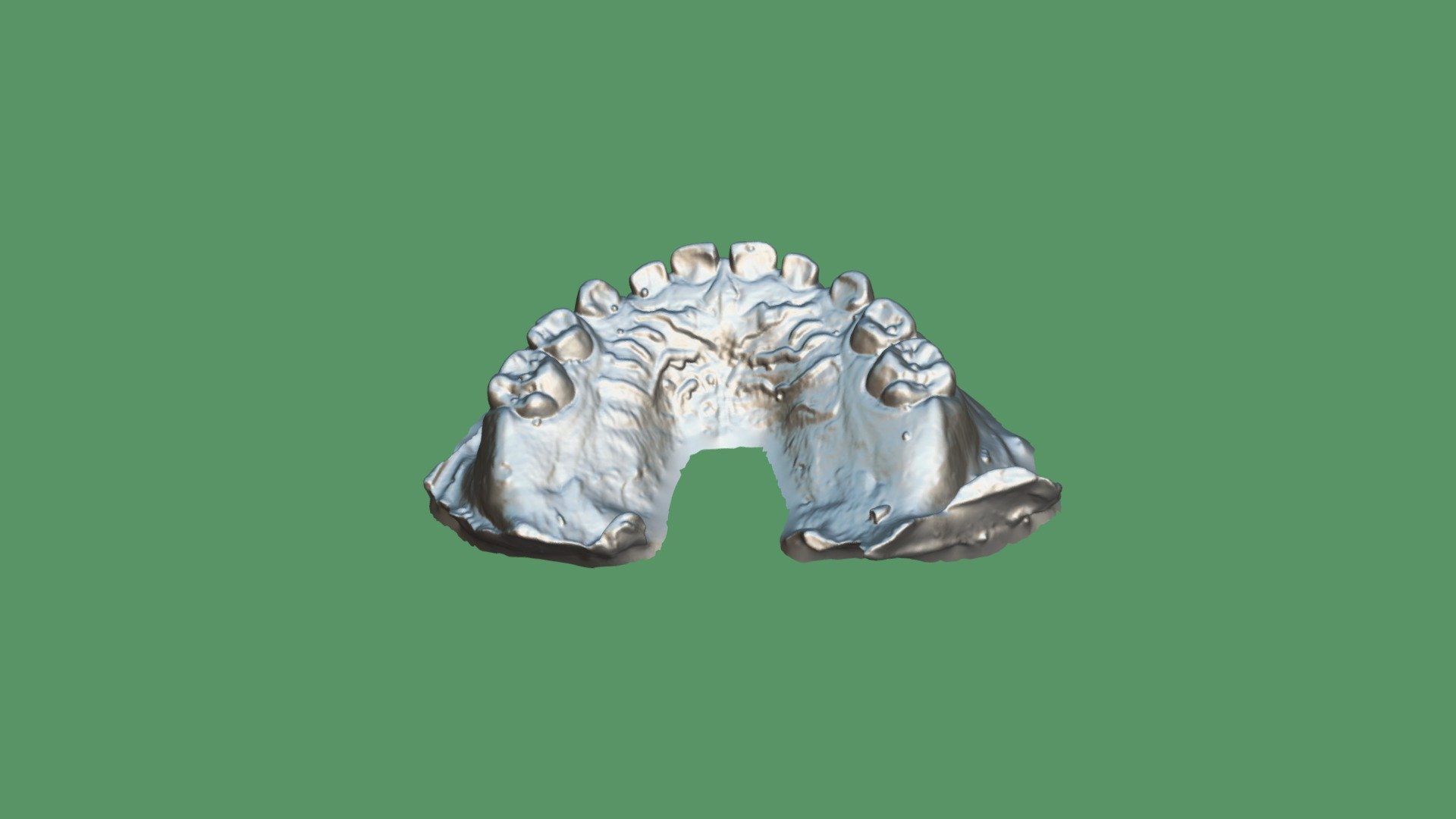 Down Jaw