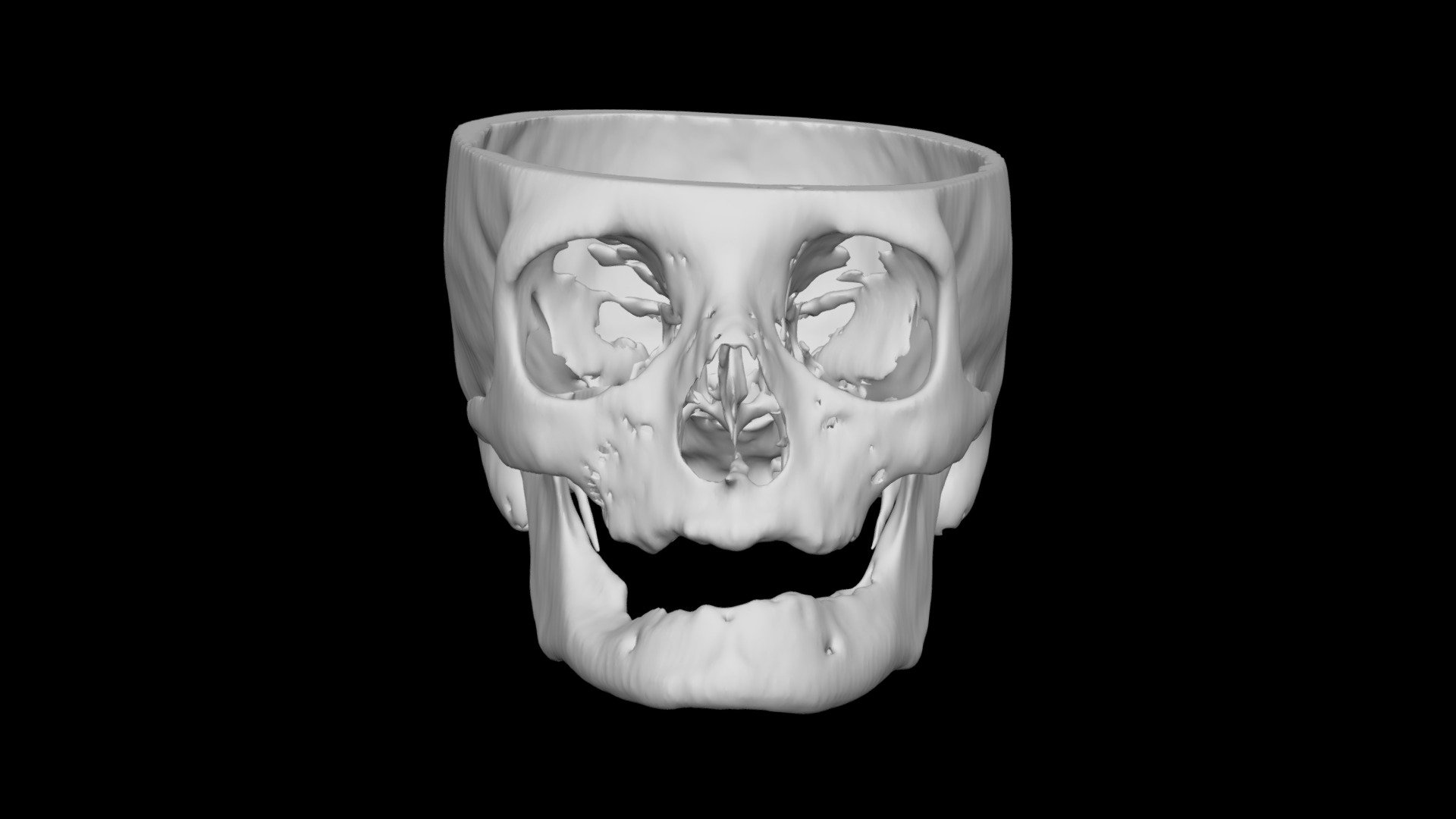 Skull Female 61yo