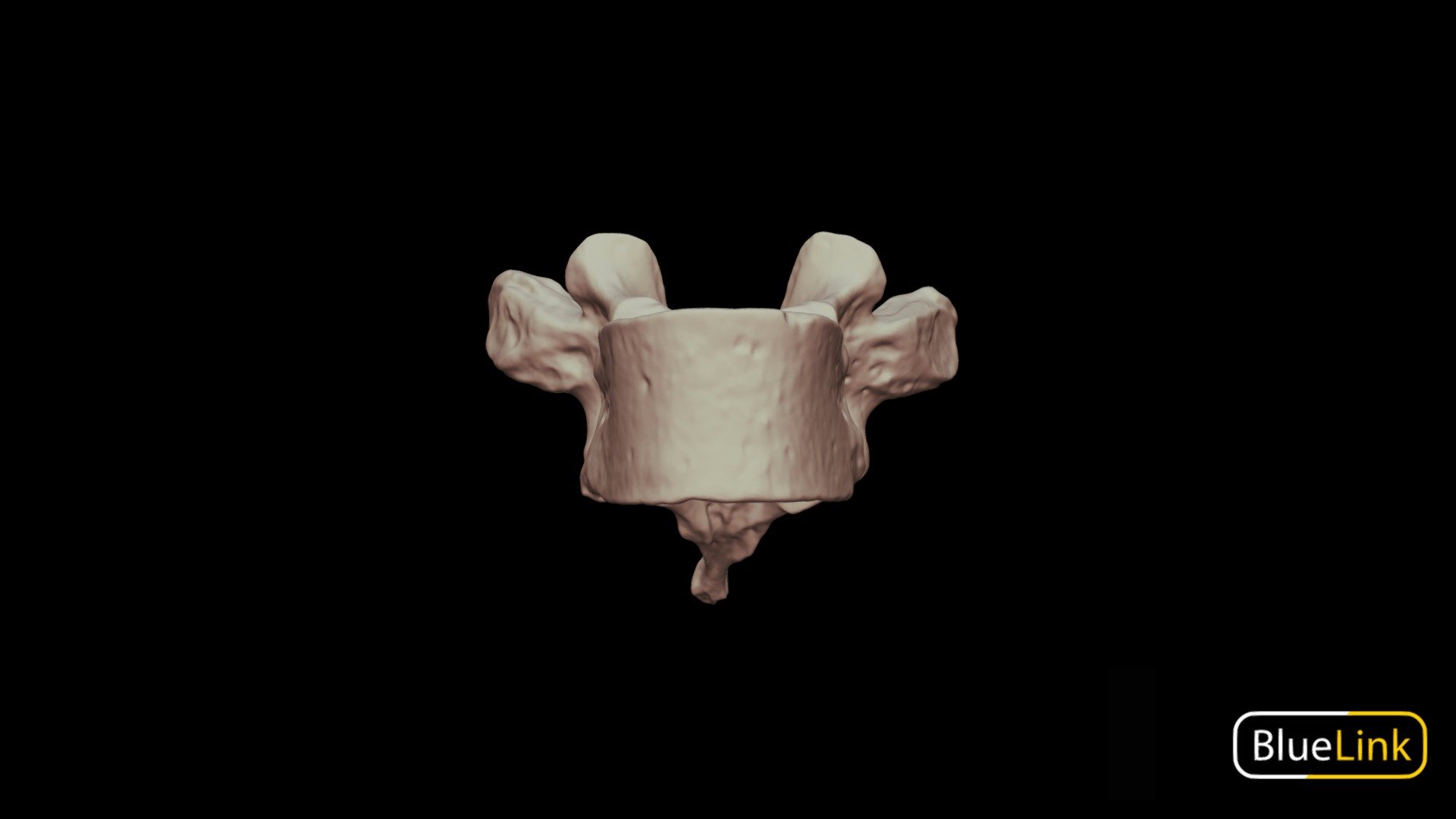 Thoracic Vertebrae - T3, Labeled - 3D Model By Bluelink Anatomy ...