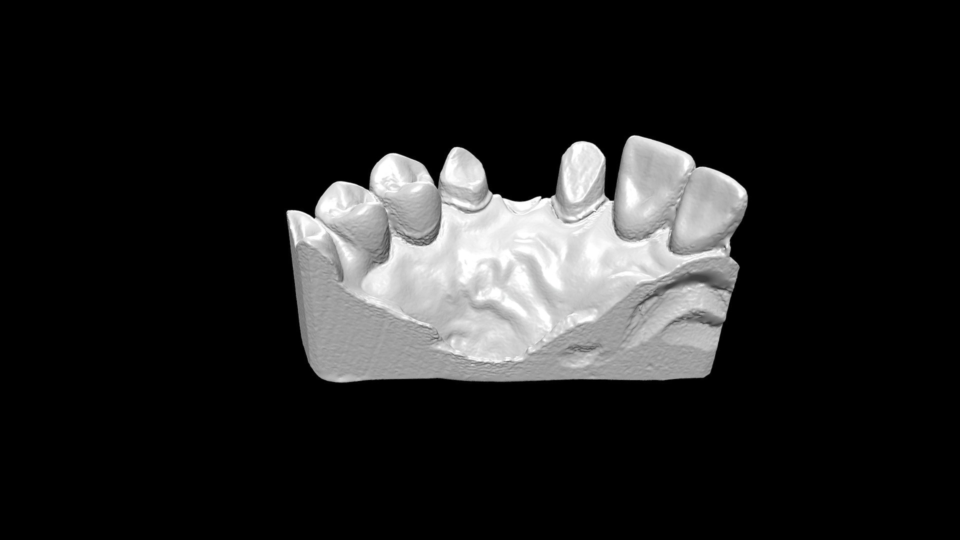 Teeth 03