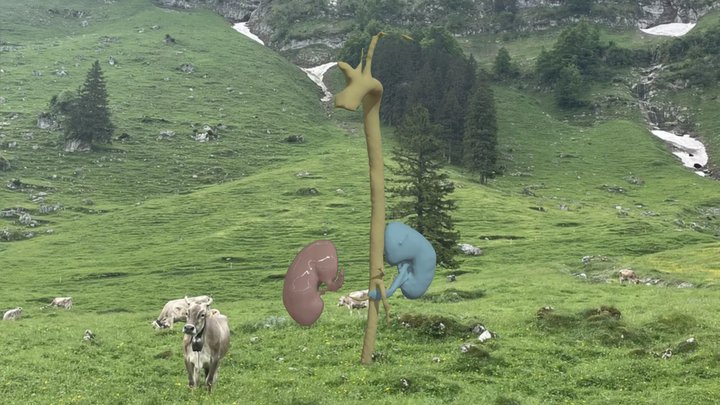 Salcedo Segmentation 3D Model