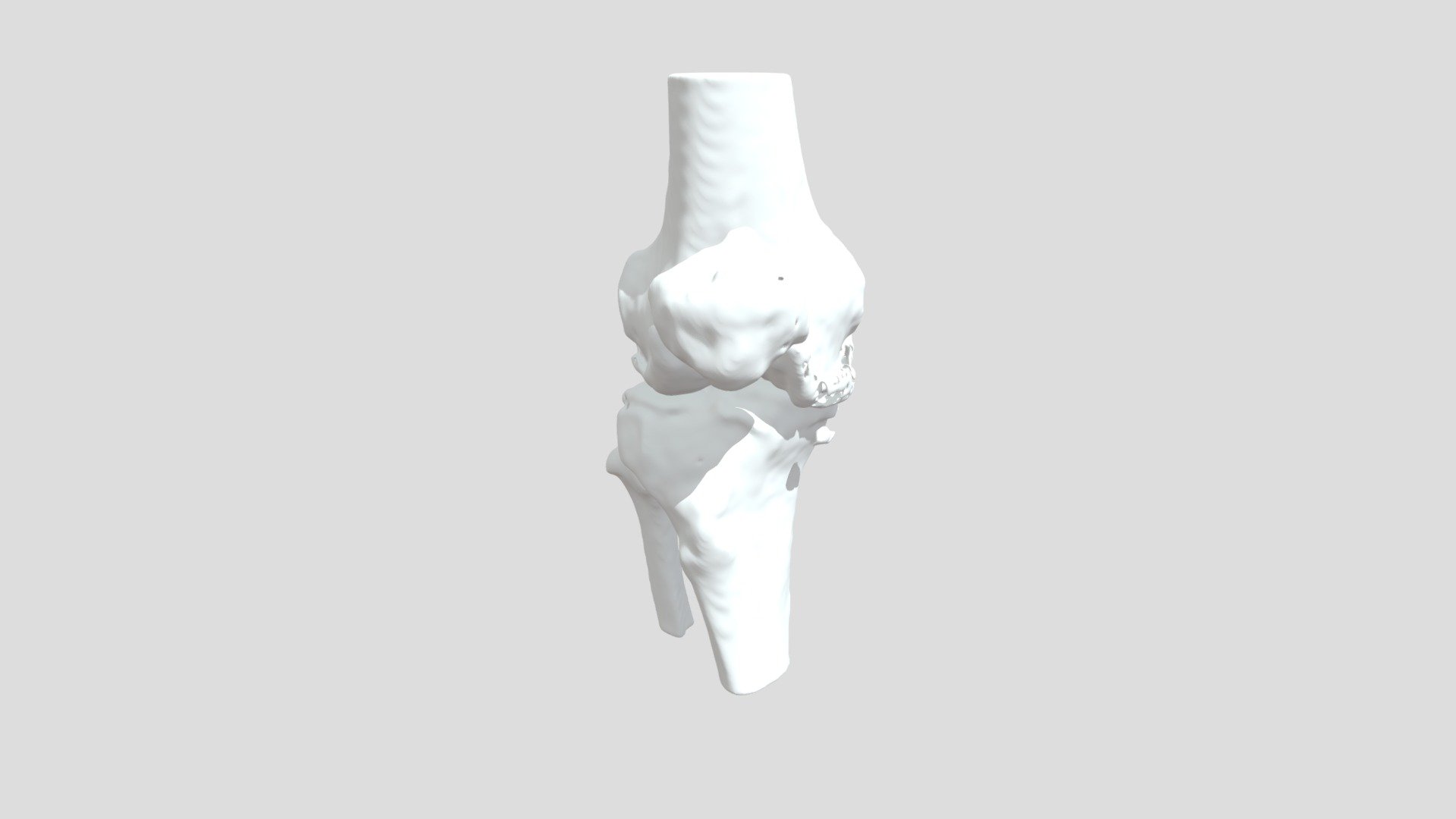 Segmentation Pbhanrtbone