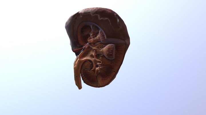 Artificial Kidney C1 3D Model