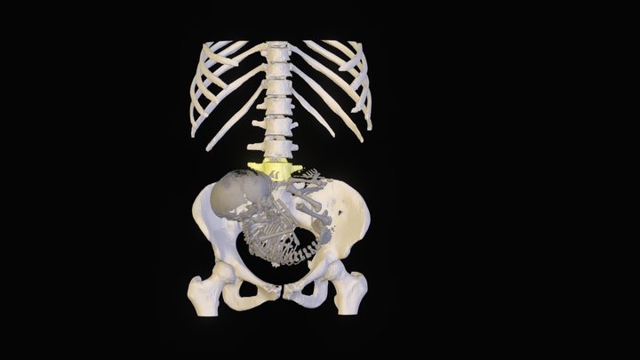 L4 Segmentation 3D Model