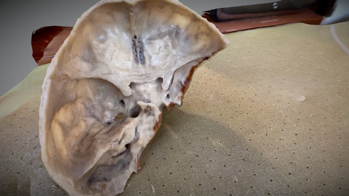 Skull 3D Model