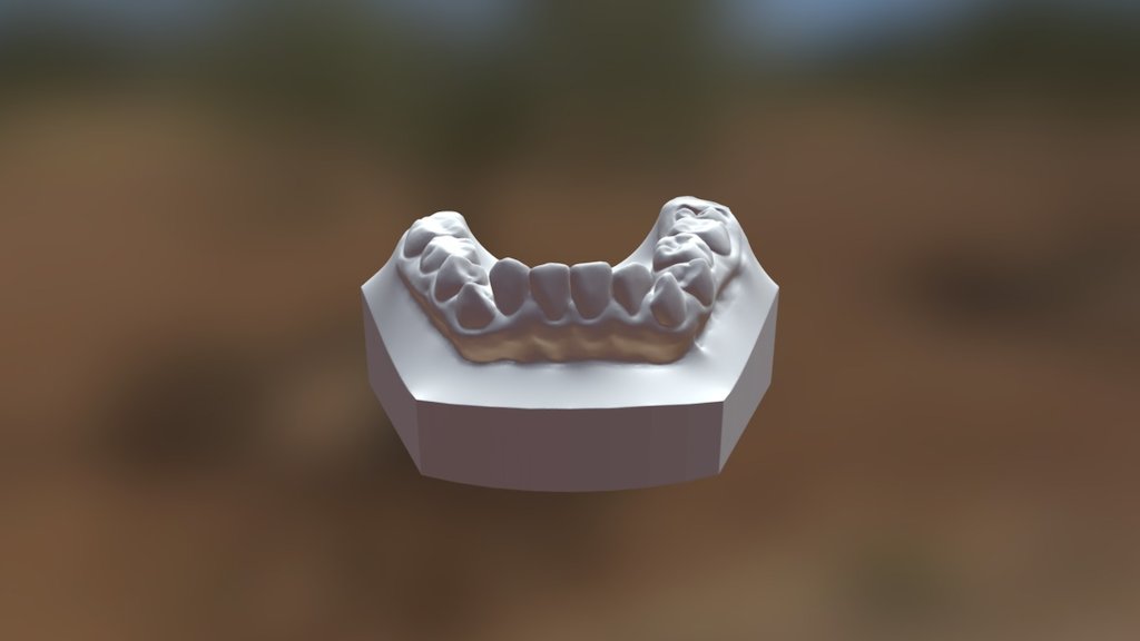 Modelo inferior en dentición mixta