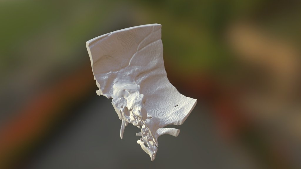 Temporal Bone Dataset 2