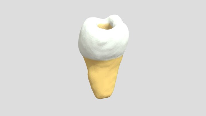 Sistema de conductos de un molar mandibular 3D Model
