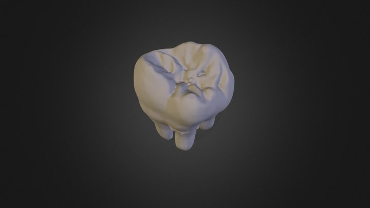 Tooth 1 3D Model