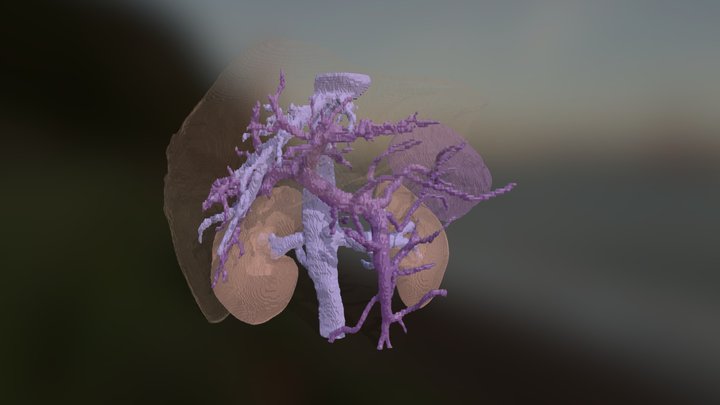 liver vasculature 3D Model