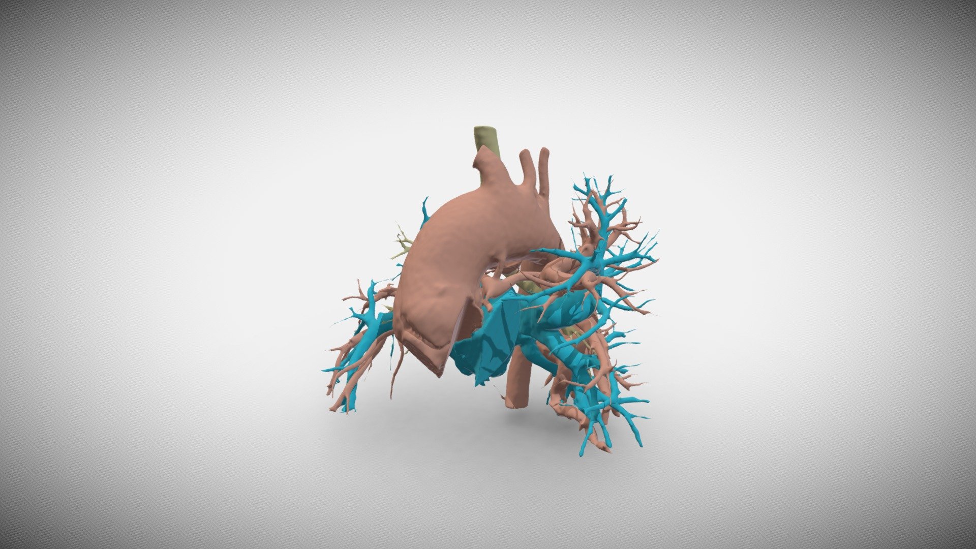 MAPCA_12 - 3D model by Imre J. Barabás, MD, M.Sc. (@Uzzias18) [f86bd6f ...