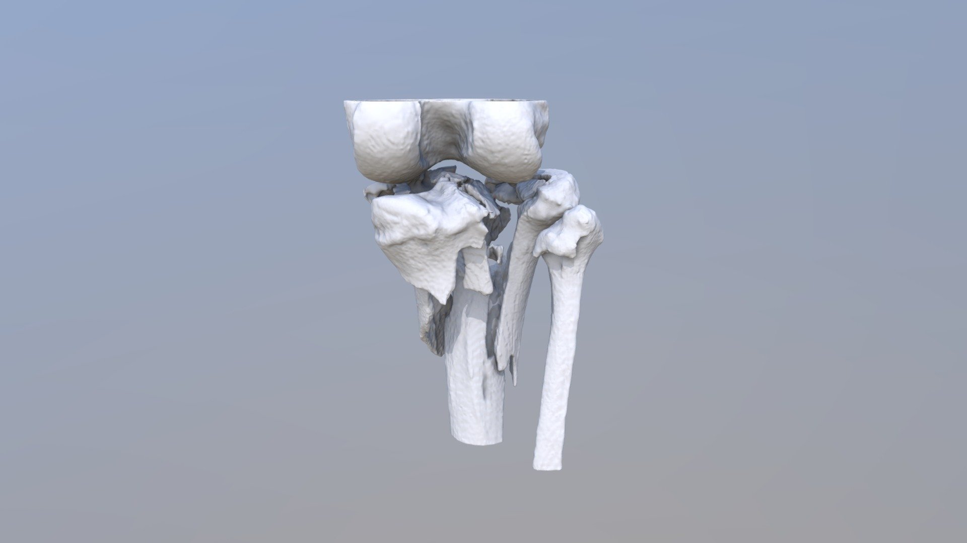 08.11 LI
