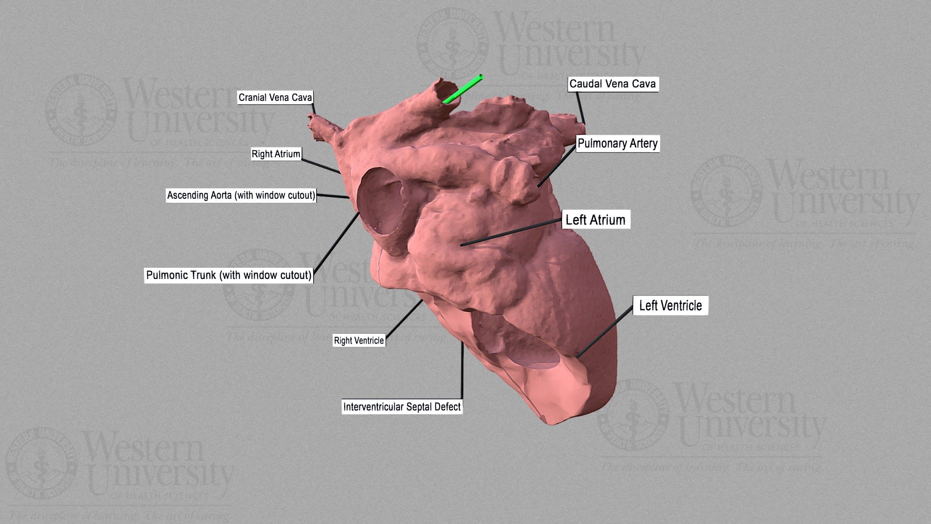 Tin Man PBL Case - Heart 3D Reconstruction