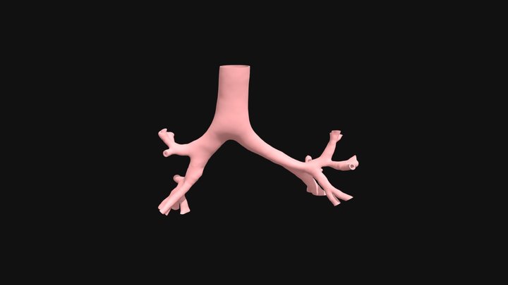 Simulador_ Broncoscopi_resumit 3D Model