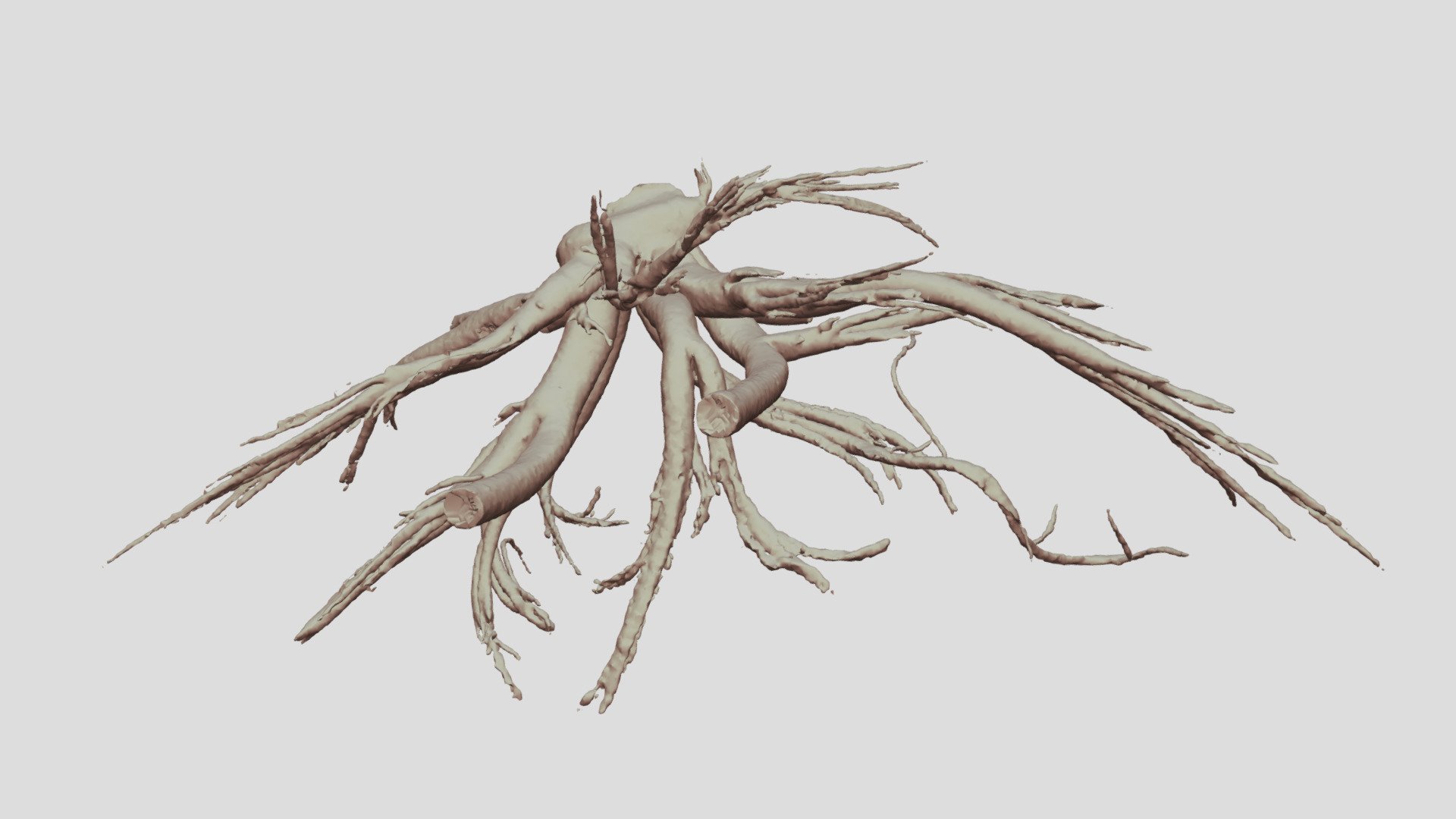 Cacosceles newmannii larva tracheae. Sample Nr8