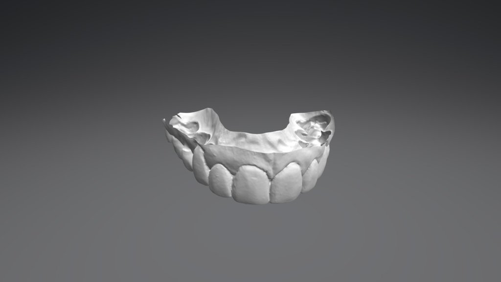Karen Upper Jaw