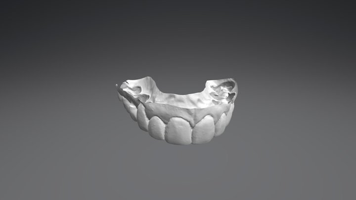 Karen Upper Jaw 3D Model
