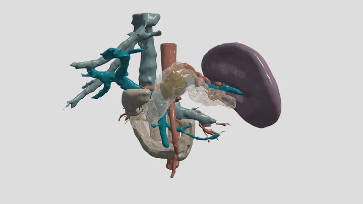 Pancreas tumor - Surgical planning 3D rendering 3D Model