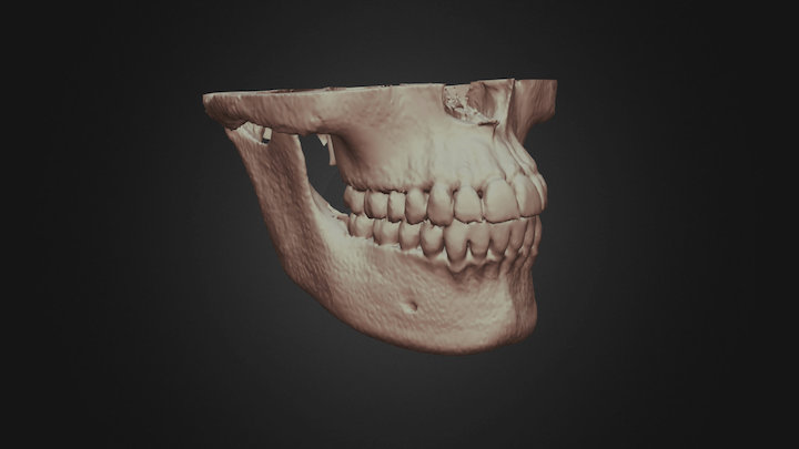 CBCT Dental Study 3D Model