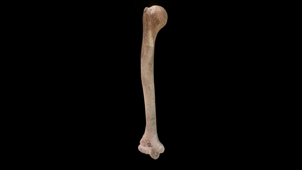Retroversión humeral - 3D model by F Cortés (@fondecy1151203) [f964fae ...