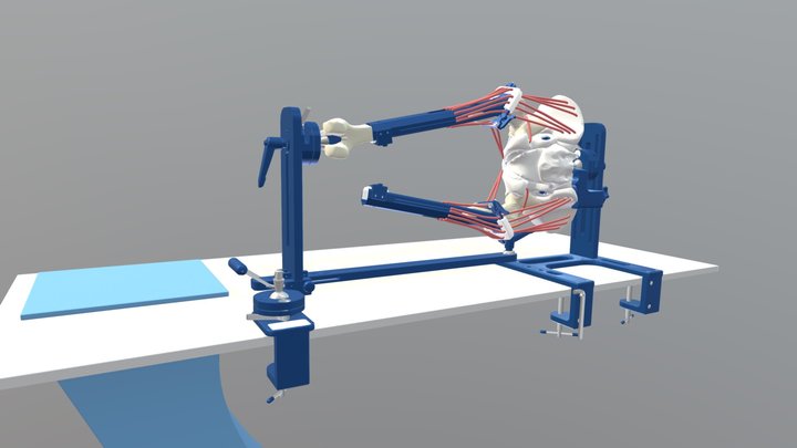 MITA XR Hip workstation - LDC to Supine 3D Model