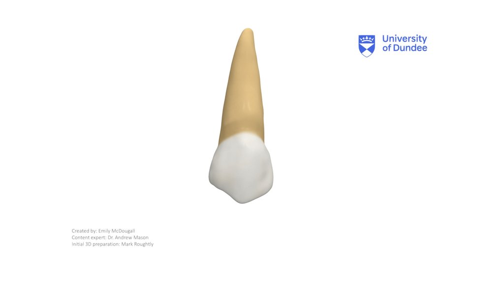 Maxillary First Premolar