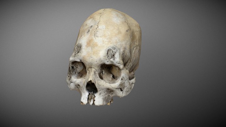 Cráneo arqueológico con caries sicca 3D Model