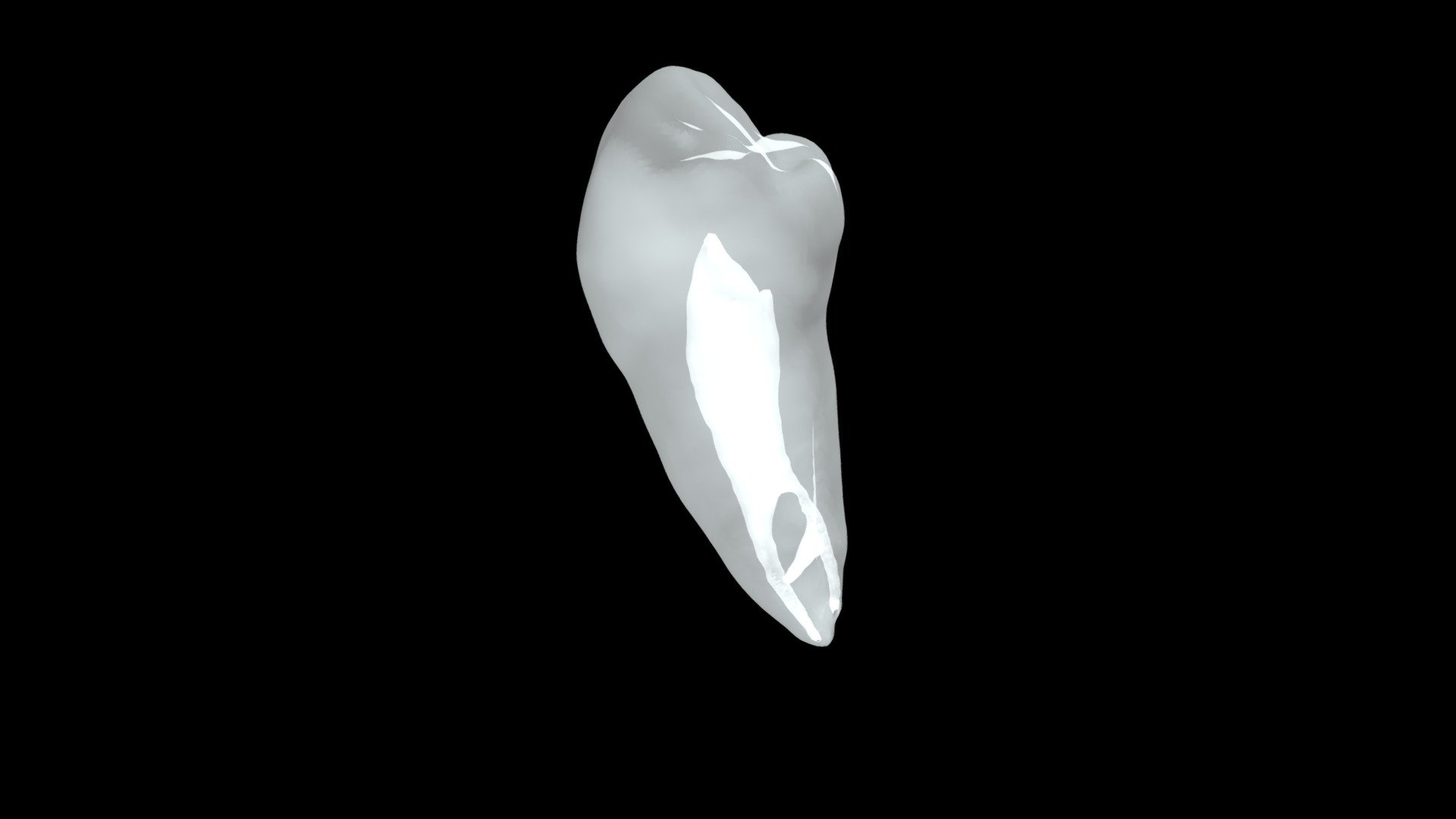 tooth 28 - 3D model by biomed3d [fa0dbc5] - Sketchfab