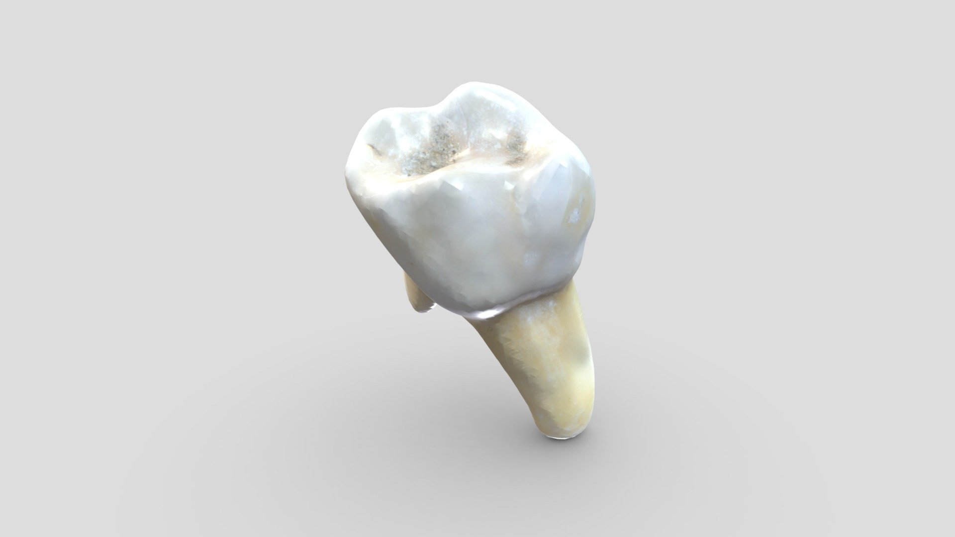 Diente Arquitectura dental