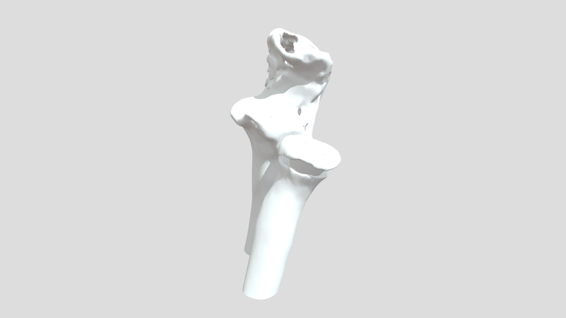 Elbow - RG - Radius Ulna - Download Free 3D model by orto3d [fa33c72 ...