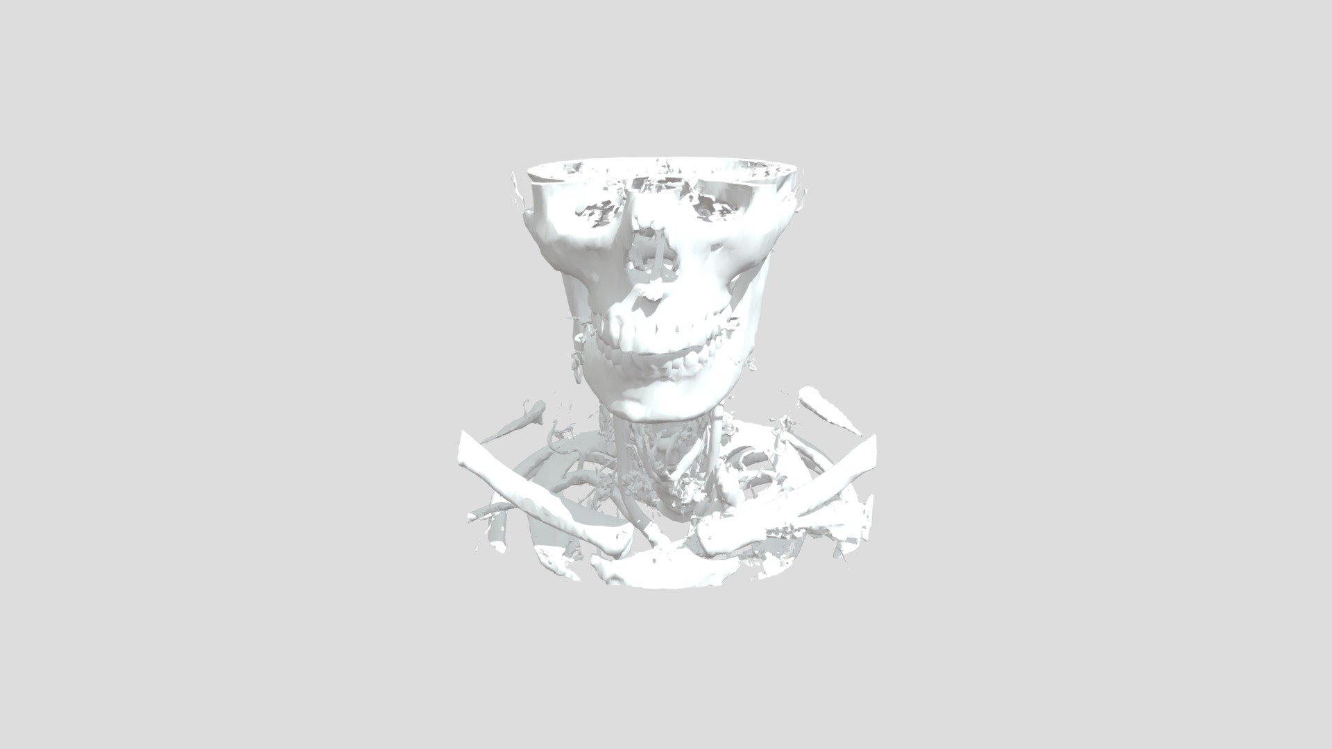 Skull