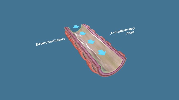 Drug Therapy for Asthma and COPD 3D Model