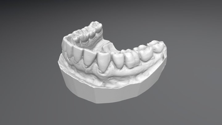 Real Gypsum Denture - Lower Part 3D Model