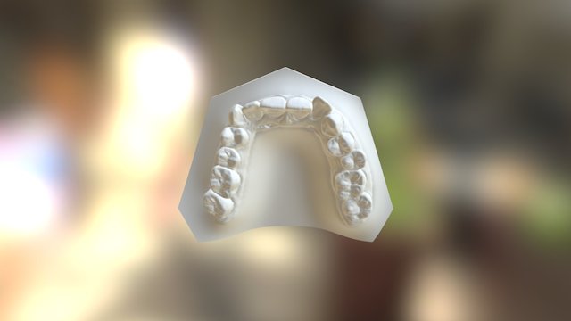 矯正前-上顎 3D Model