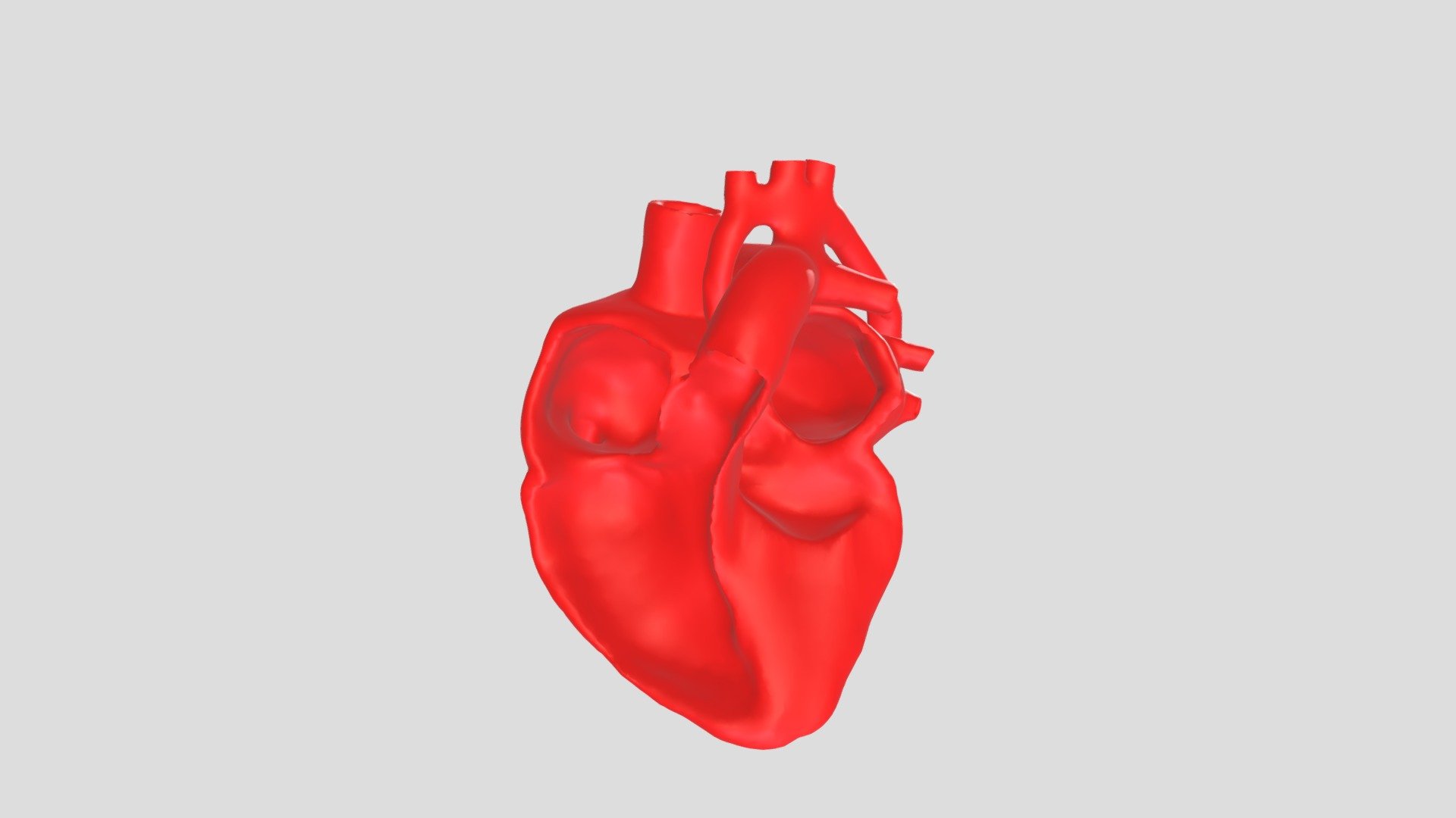 Hypoplastic Left Heart Syndrome
