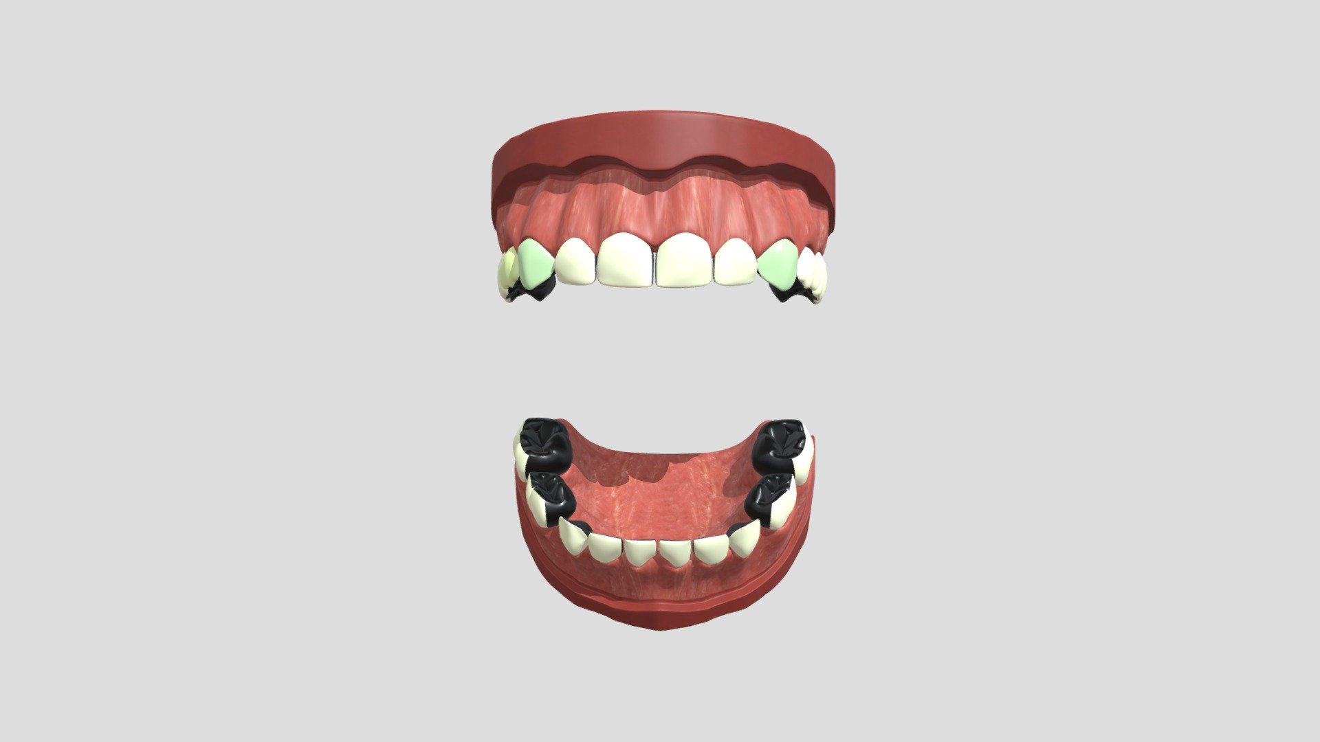 hypo_nzunrestored_4cm_2c