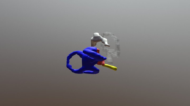 preop with no bone 3D Model
