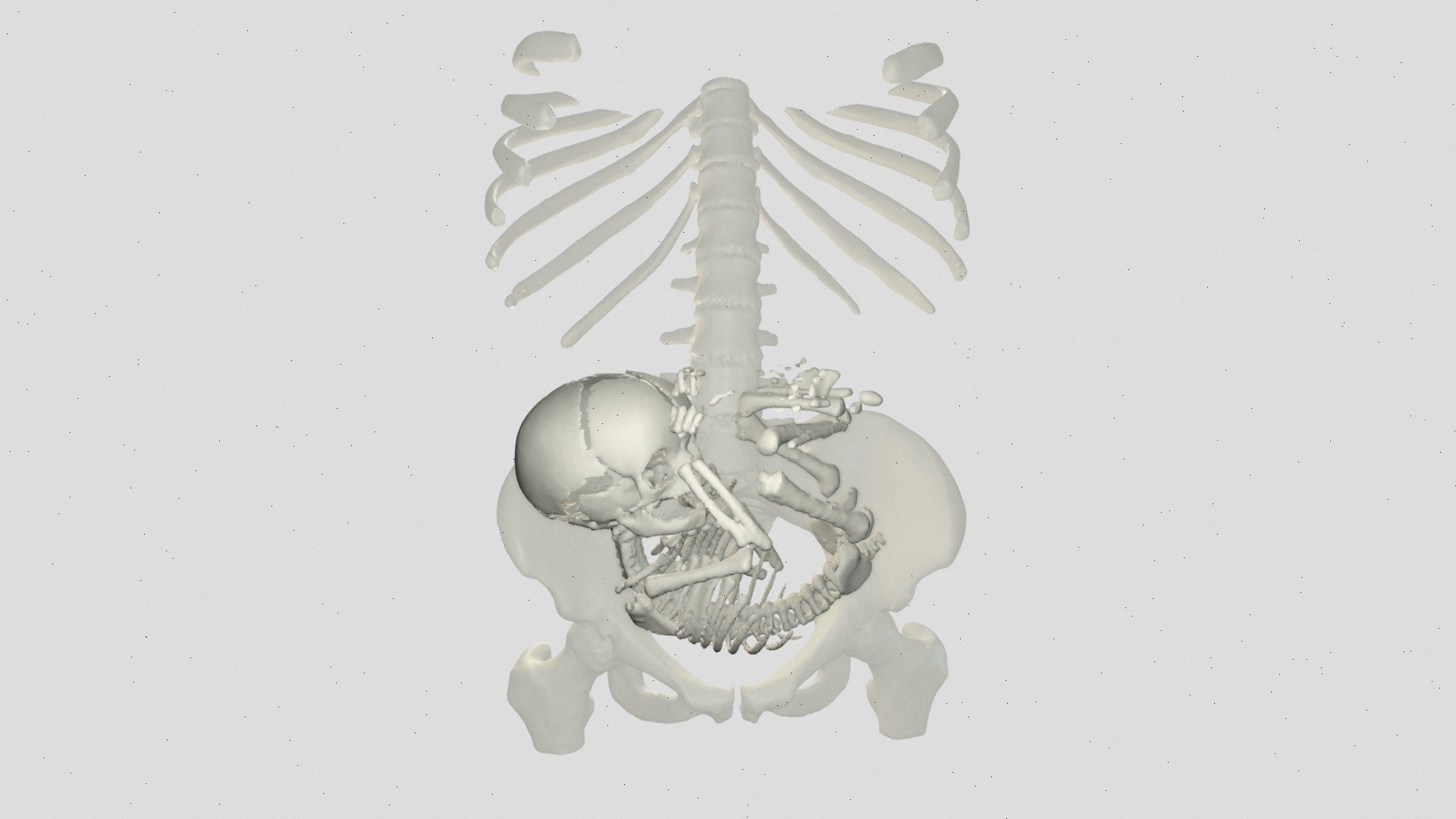 Fetal Skeleton (38 weeks GA) - Download Free 3D model by adazo [fb17717 ...